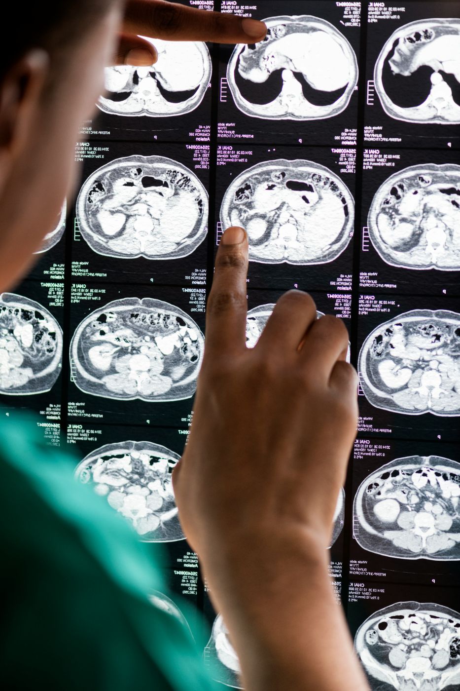 A doctor reviews brain scan images on a screen with a patient’s family member, illustrating a traumatic brain injury claim in South Carolina