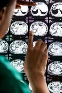 Looking at brain scans